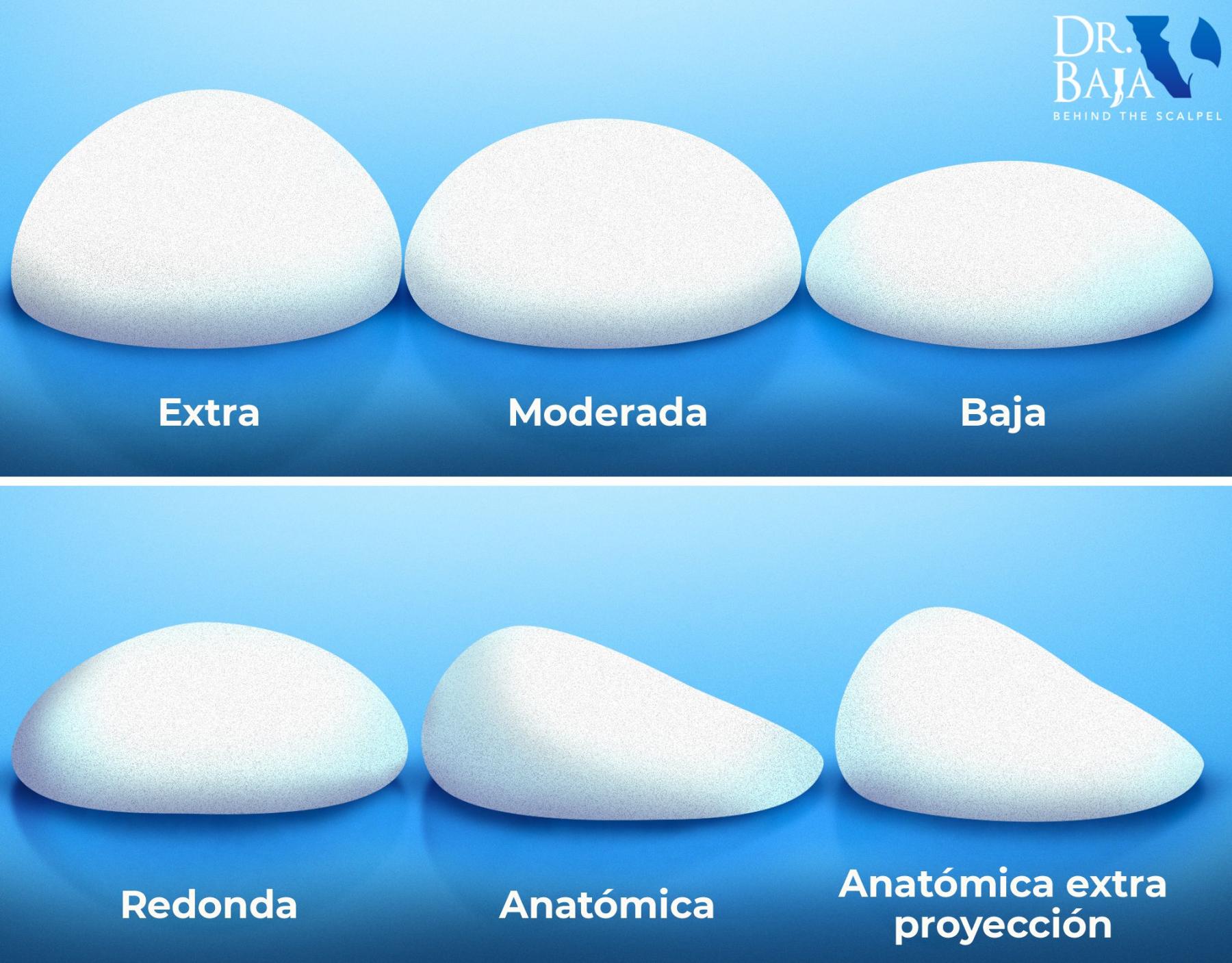 tipos de implantes